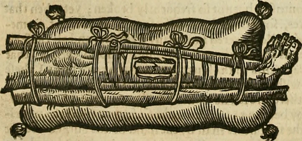 An illustration from The workes of that famous chirurgion Ambrose Parey :, 1649, leaf 399