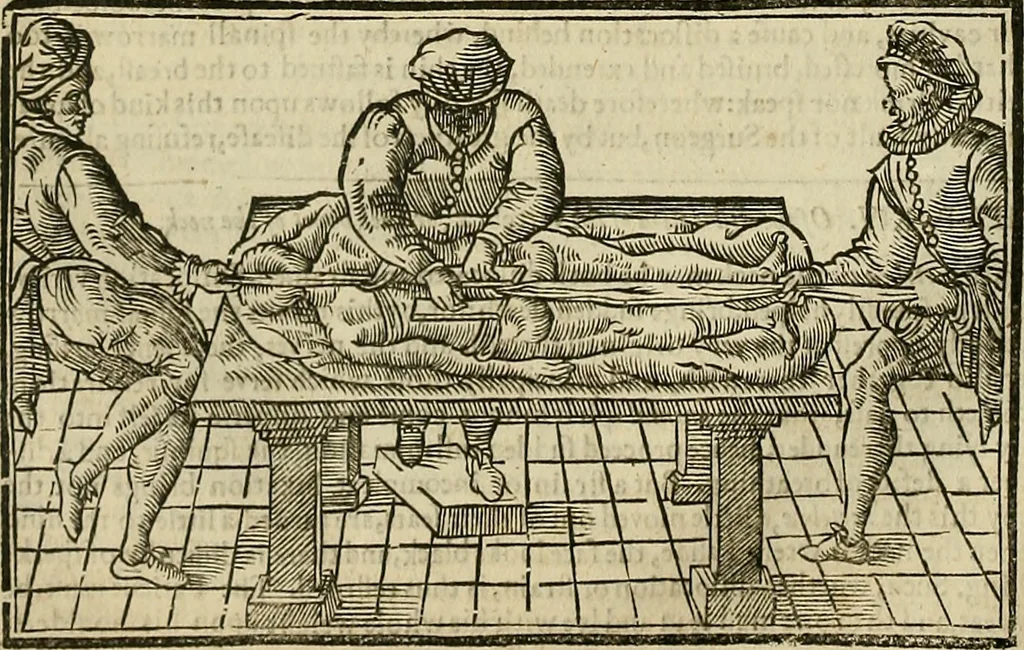 An illustration from The workes of that famous chirurgion Ambrose Parey :, 1649, leaf 411