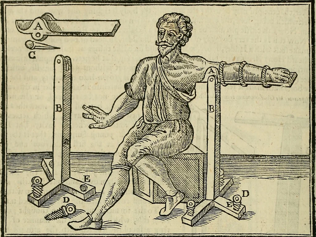 An illustration from The workes of that famous chirurgion Ambrose Parey :, 1649, leaf 419