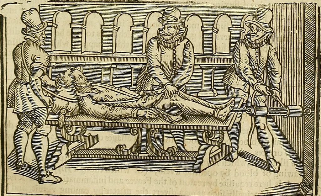 An illustration from The workes of that famous chirurgion Ambrose Parey :, 1649, leaf 430
