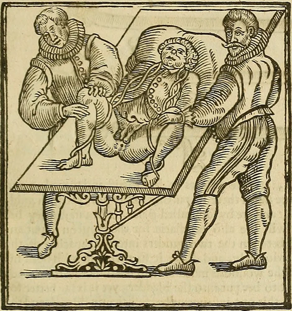 An illustration from The workes of that famous chirurgion Ambrose Parey :, 1649, leaf 462