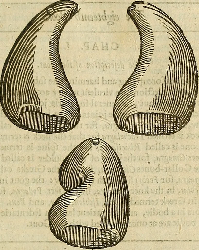 An illustration from The workes of that famous chirurgion Ambrose Parey :, 1649, leaf 480
