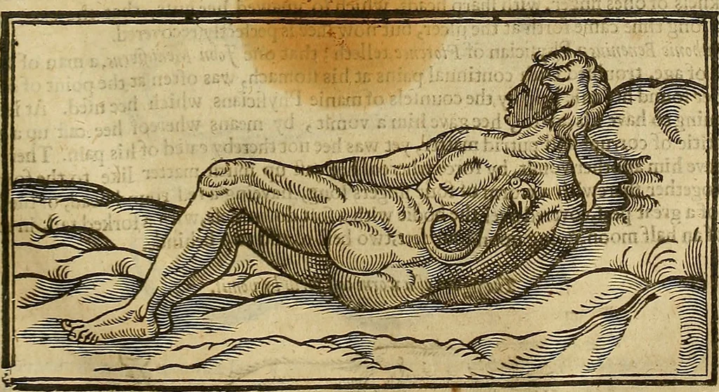 An illustration from The workes of that famous chirurgion Ambrose Parey :, 1649, leaf 530