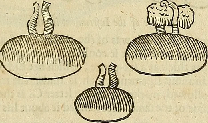 An illustration from The workes of that famous chirurgion Ambrose Parey :, 1649, leaf 614