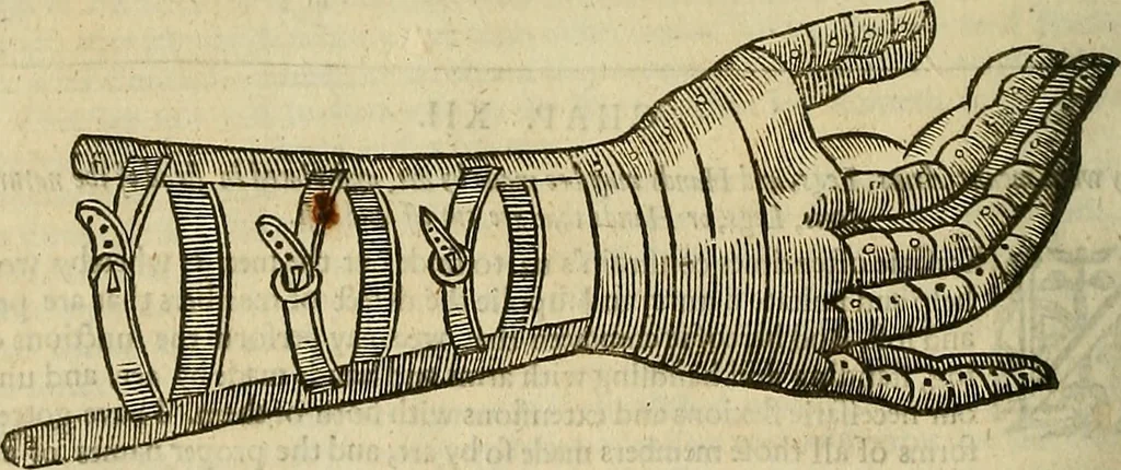 An illustration from The workes of that famous chirurgion Ambrose Parey :, 1649, leaf 621