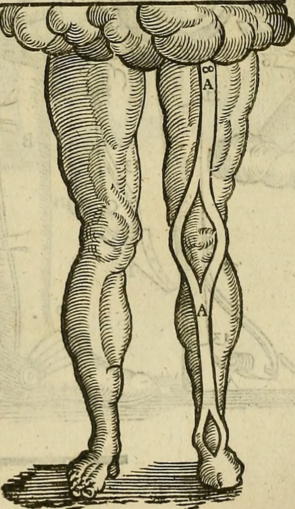 An illustration from The workes of that famous chirurgion Ambrose Parey :, 1649, leaf 623