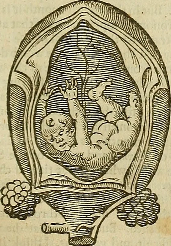 An illustration from The workes of that famous chirurgion Ambrose Parey :, 1649, leaf 636