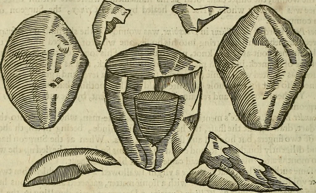 An illustration from The workes of that famous chirurgion Ambrose Parey :, 1649, leaf 709