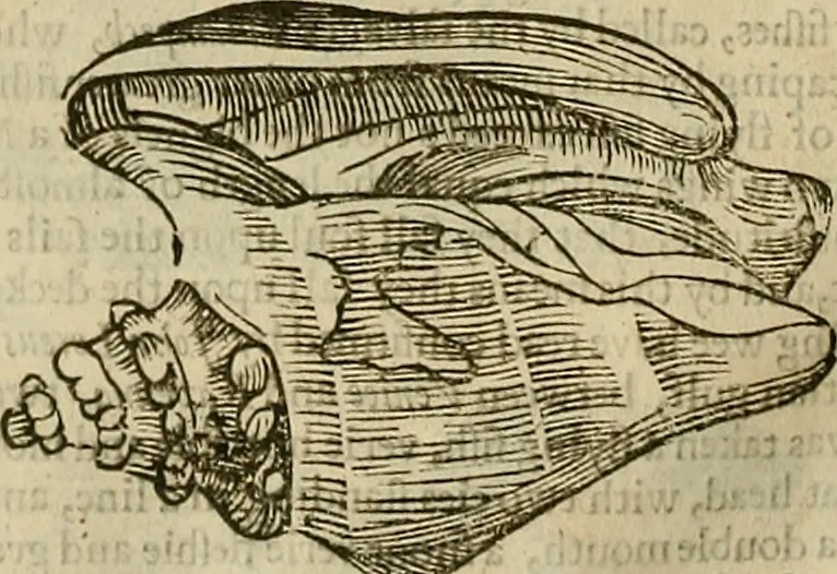 An illustration from The workes of that famous chirurgion Ambrose Parey :, 1649, leaf 717