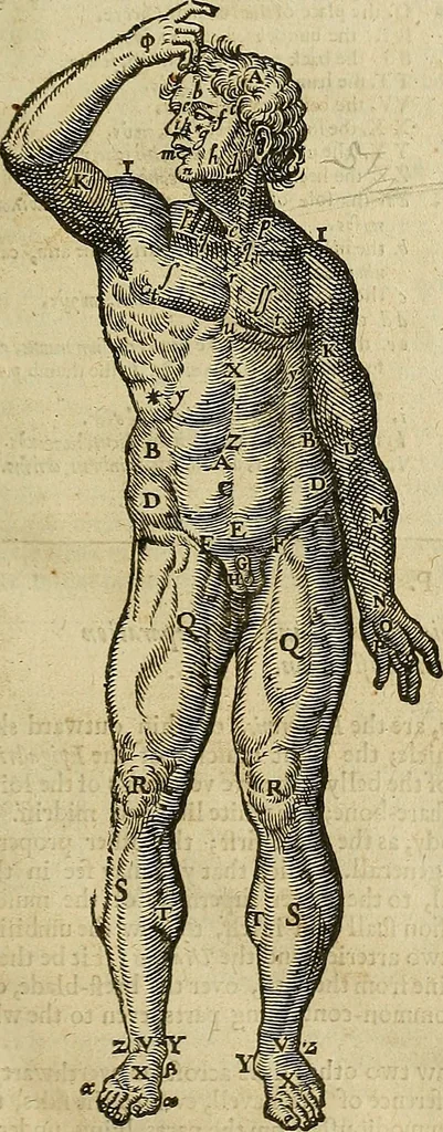 An illustration from The workes of that famous chirurgion Ambrose Parey :, 1649, leaf 90