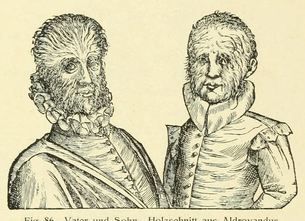 An illustration from Wunder, Wundergeburt und Wundergestalt in Einblattdrucken des fünfzehnten bis achtzehnten Jahrhunderts; kulturhistorische Studie, 1921, leaf 176