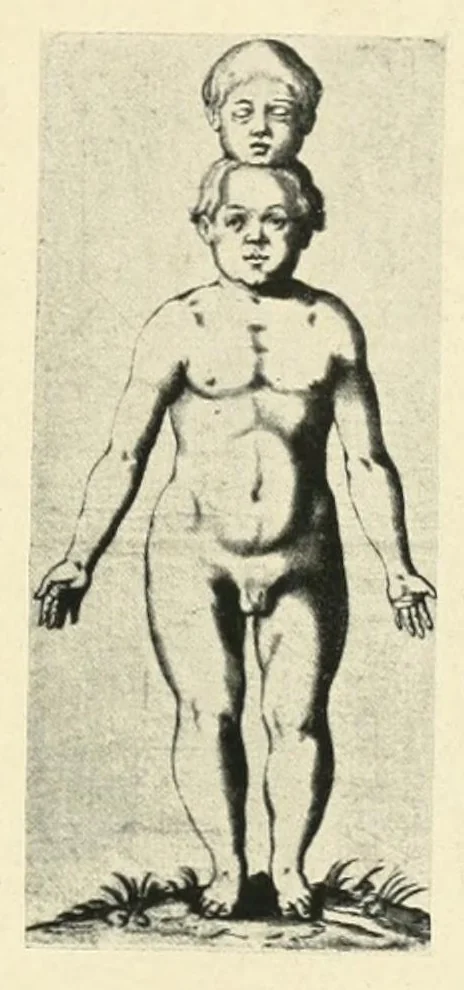 An illustration from Wunder, Wundergeburt und Wundergestalt in Einblattdrucken des fünfzehnten bis achtzehnten Jahrhunderts; kulturhistorische Studie, 1921, leaf 305