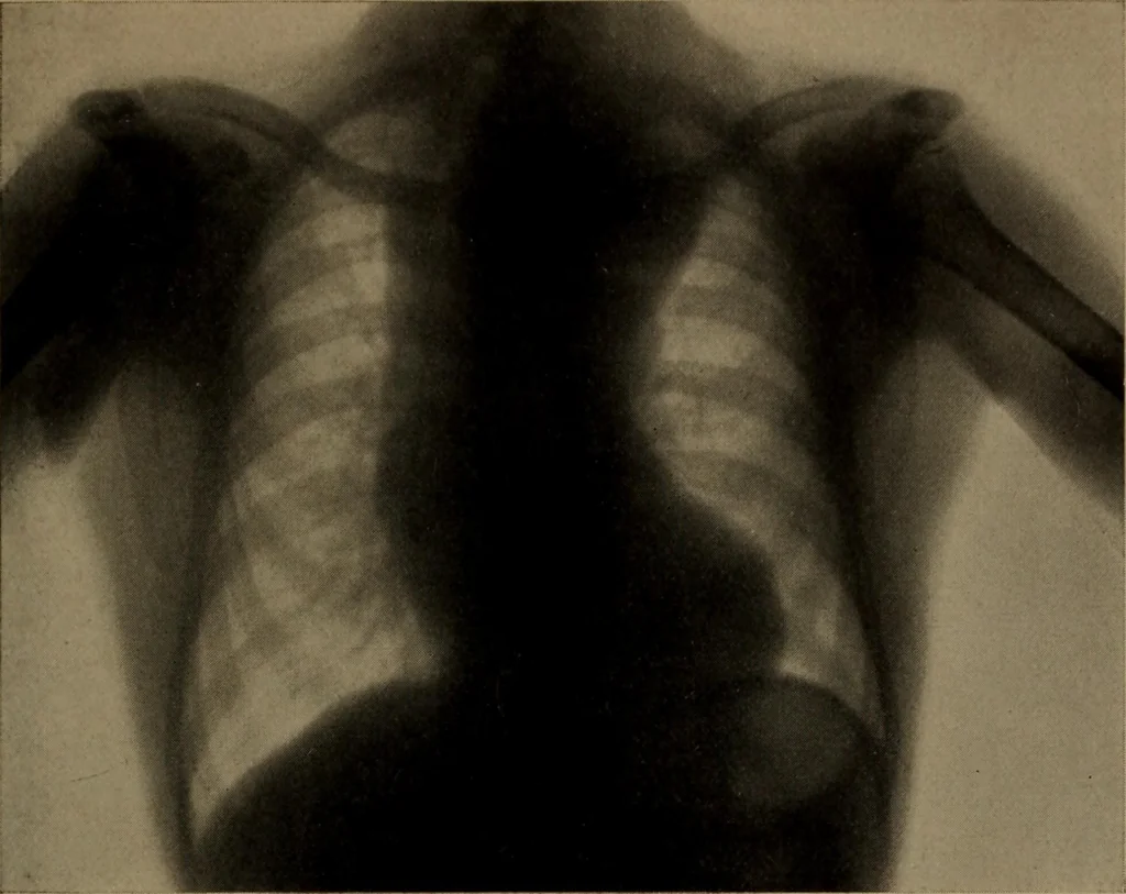An illustration from X-ray apparatus : complete outfits and accessories for X-ray laboratories, 1908, leaf 10