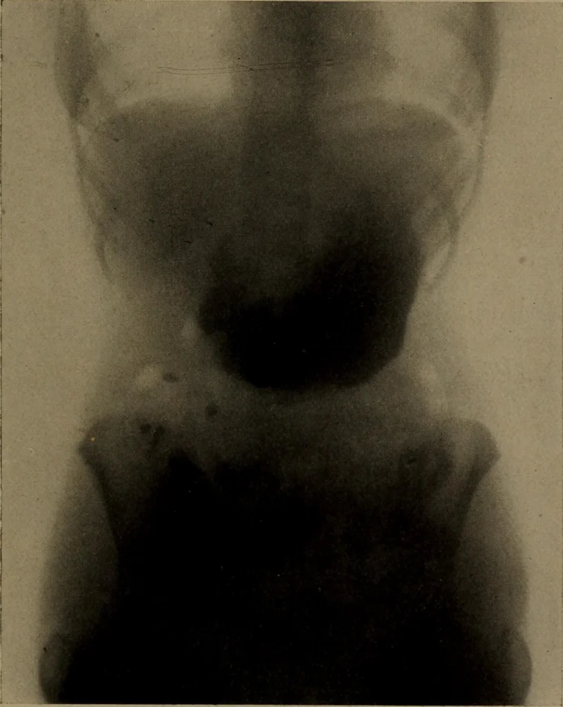 An illustration from X-ray apparatus : complete outfits and accessories for X-ray laboratories, 1908, leaf 10