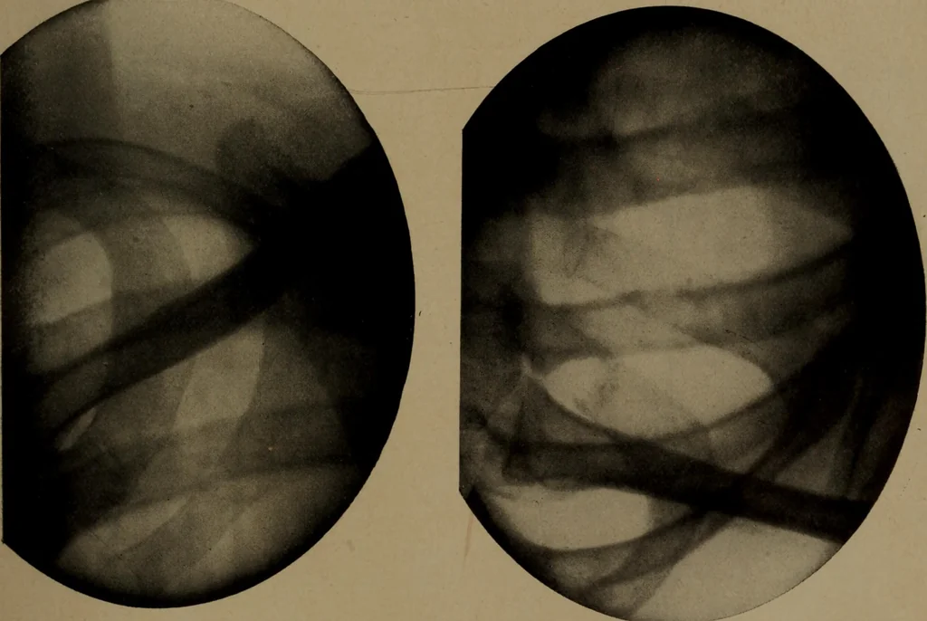 An illustration from X-ray apparatus : complete outfits and accessories for X-ray laboratories, 1908, leaf 44