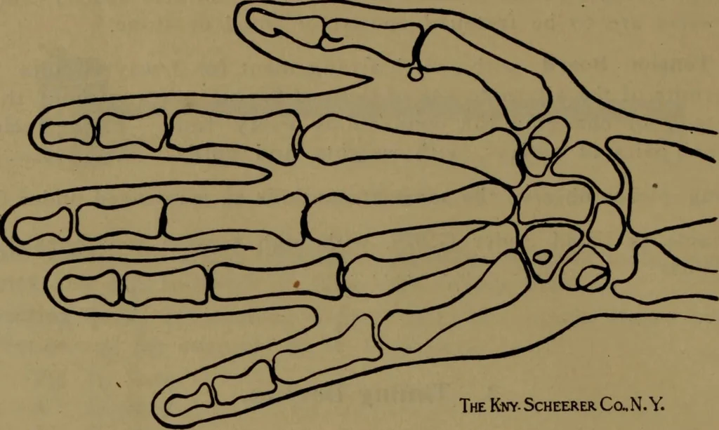 An illustration from X-ray apparatus : complete outfits and accessories for X-ray laboratories, 1908, leaf 61