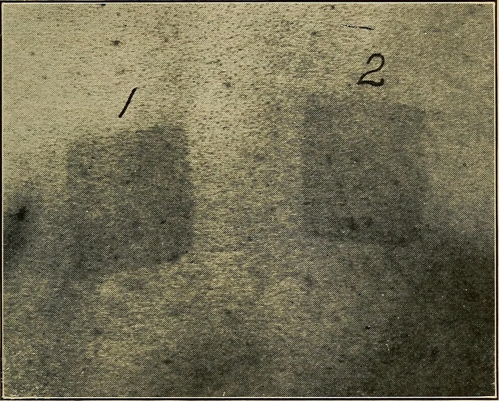 An illustration from X-ray dosage in treatment and radiography, 1922, leaf 52