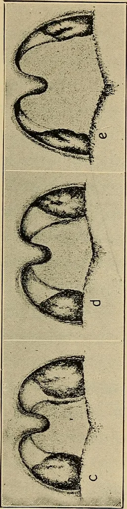 An illustration from X-ray dosage in treatment and radiography, 1922, leaf 60