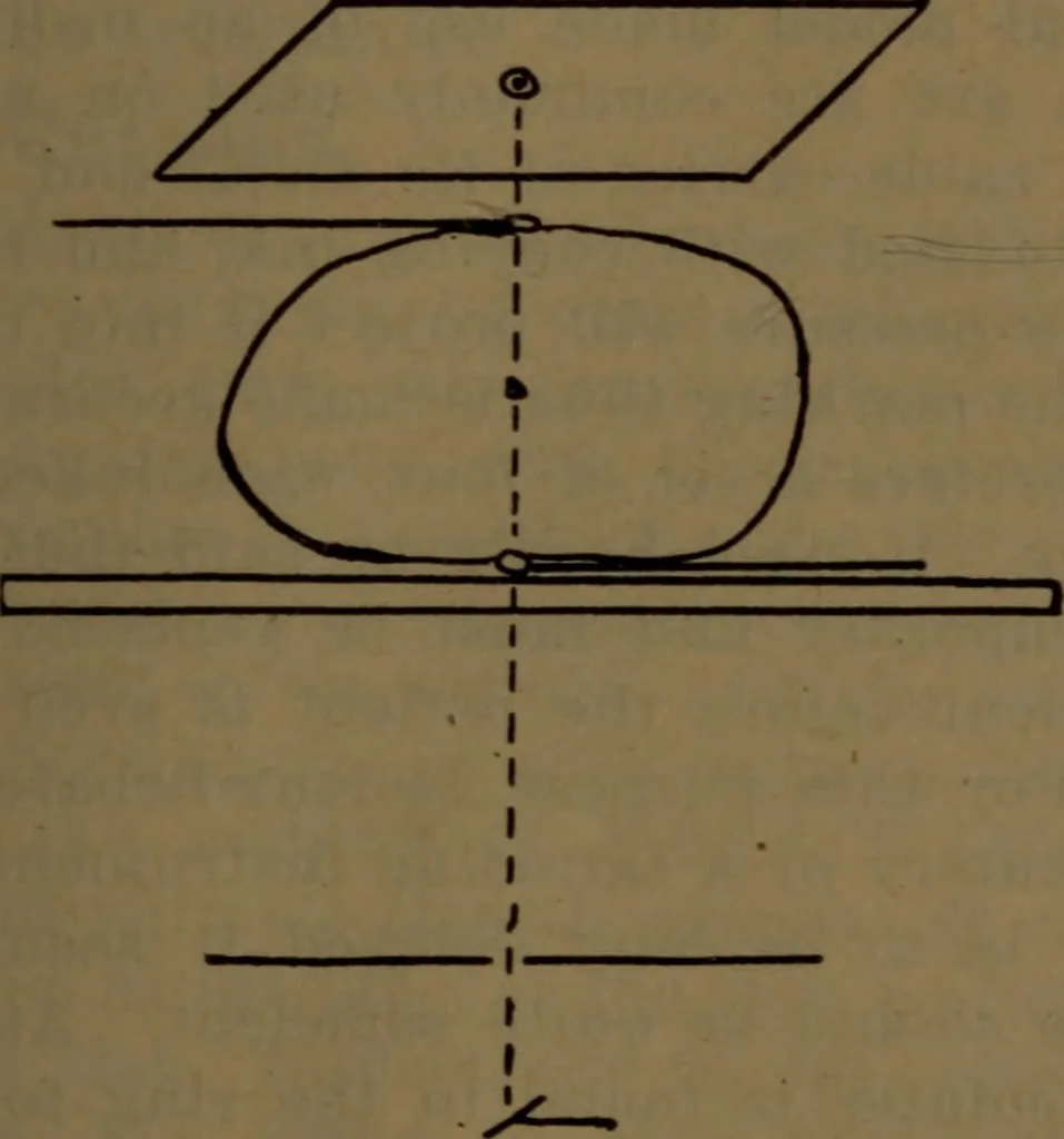 An illustration from X-ray manual : U.S. Army, 1917, leaf 172