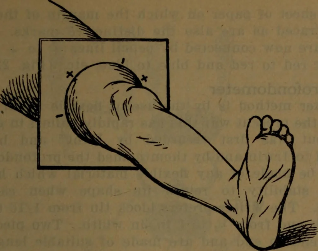 An illustration from X-ray manual : U.S. Army, 1917, leaf 176