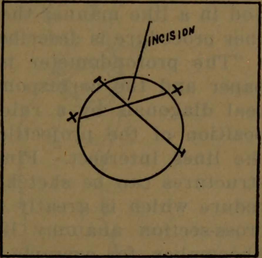 An illustration from X-ray manual : U.S. Army, 1917, leaf 176