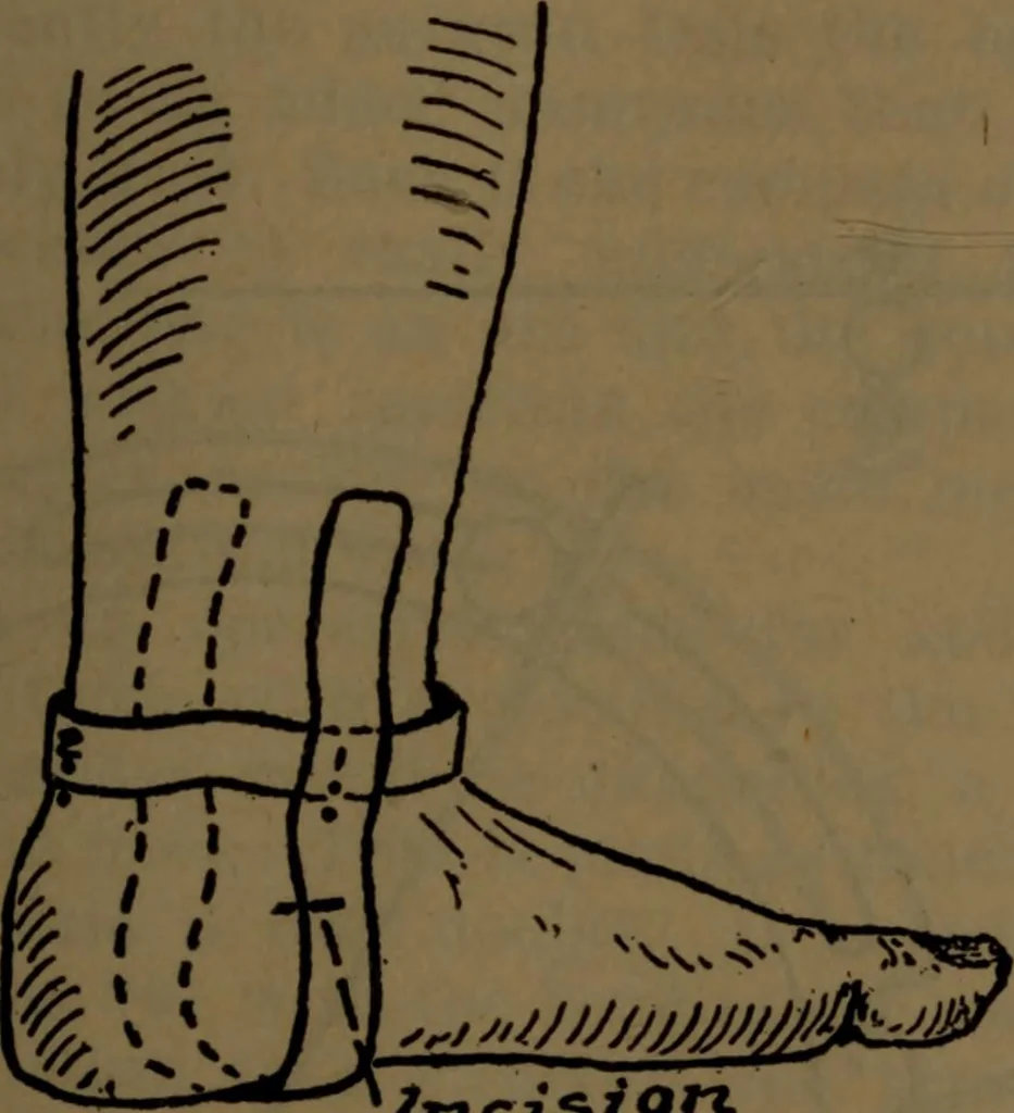 An illustration from X-ray manual : U.S. Army, 1917, leaf 180