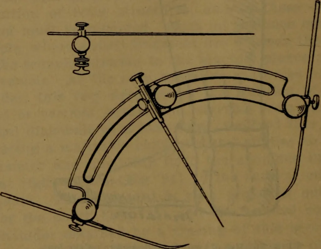 An illustration from X-ray manual : U.S. Army, 1917, leaf 181