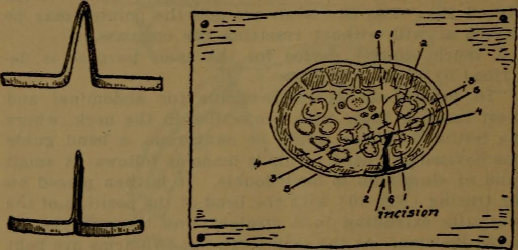 An illustration from X-ray manual : U.S. Army, 1917, leaf 183