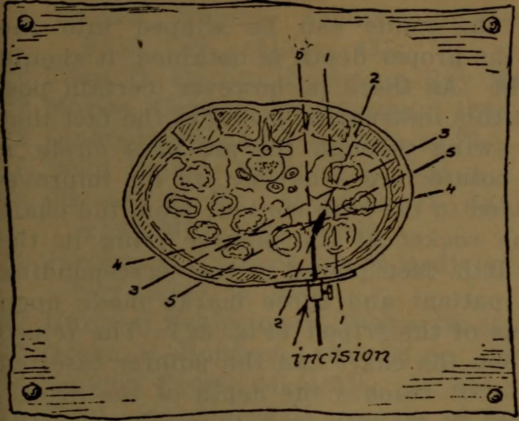 An illustration from X-ray manual : U.S. Army, 1917, leaf 184