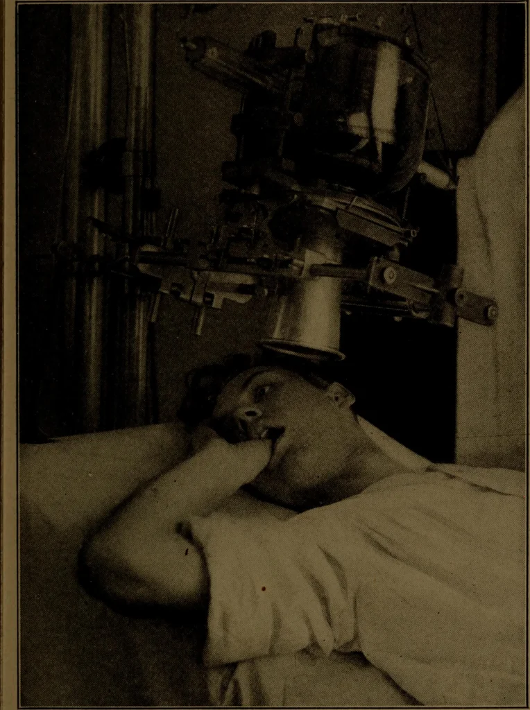 An illustration from X-ray manual : U.S. Army, 1917, leaf 228
