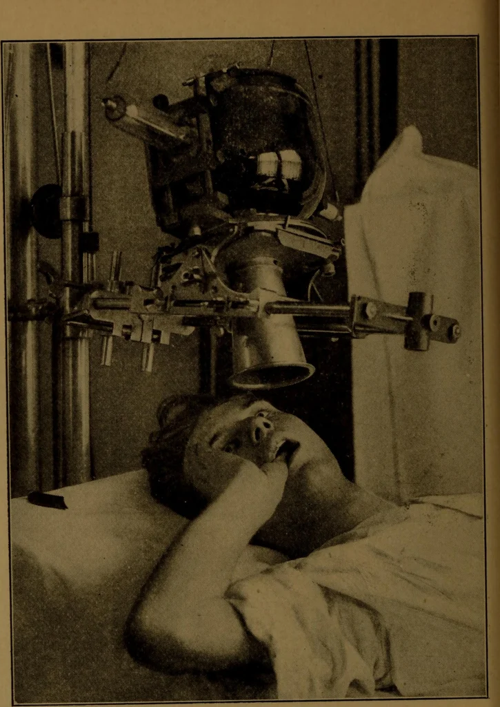 An illustration from X-ray manual : U.S. Army, 1917, leaf 229
