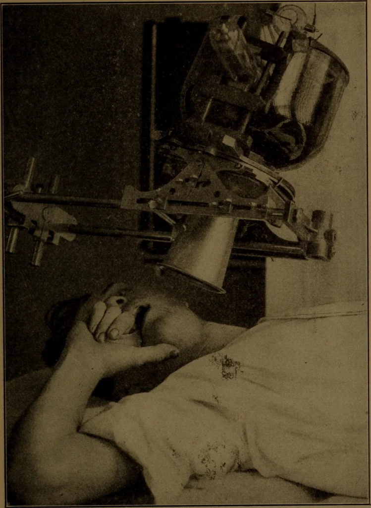 An illustration from X-ray manual : U.S. Army, 1917, leaf 230
