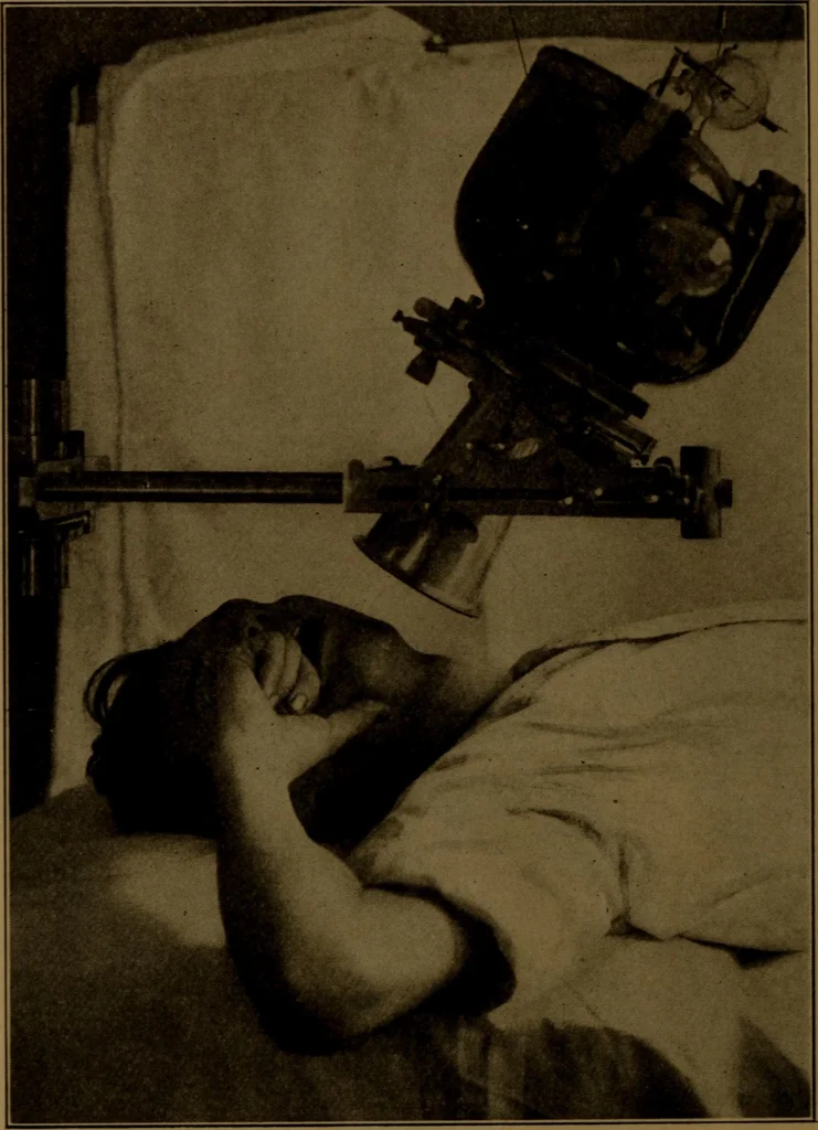 An illustration from X-ray manual : U.S. Army, 1917, leaf 231