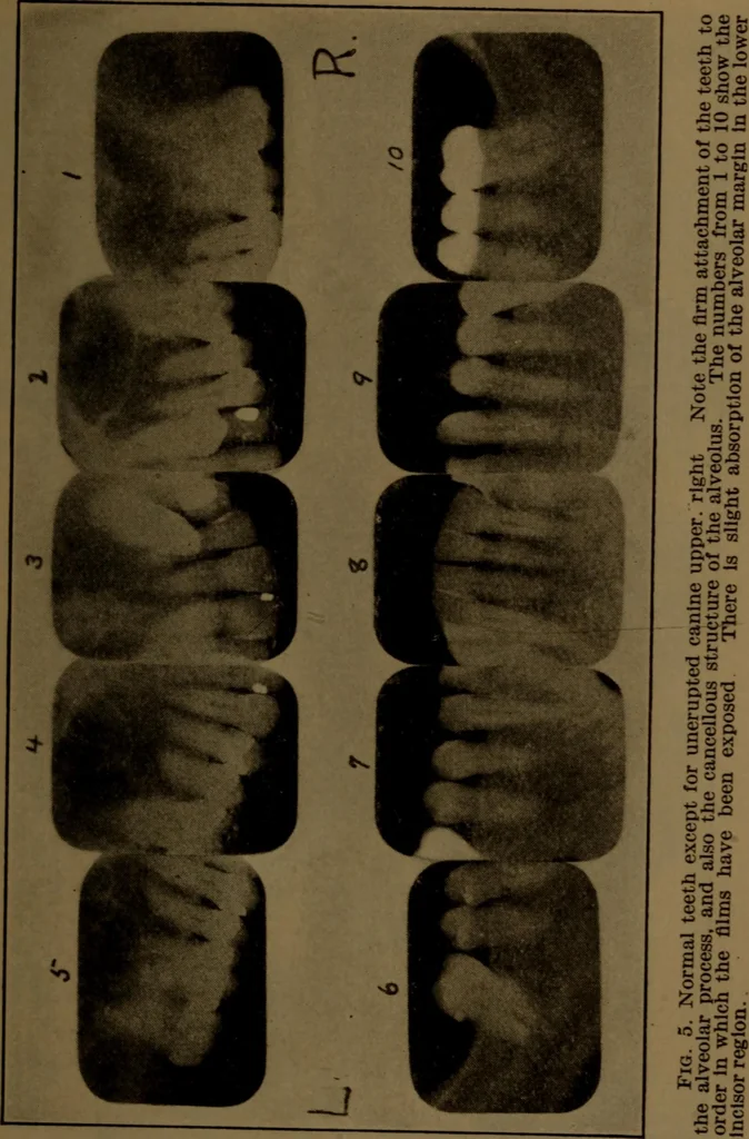 An illustration from X-ray manual : U.S. Army, 1917, leaf 232