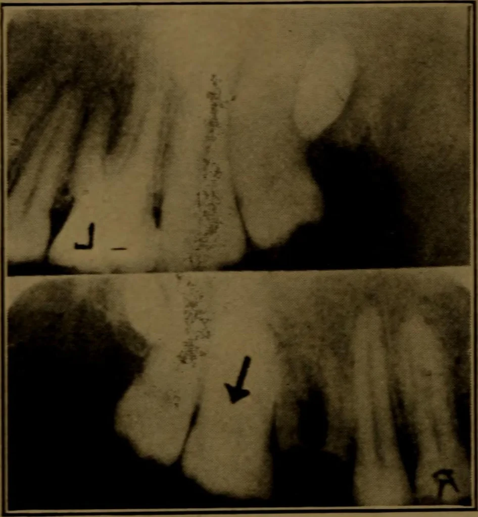 An illustration from X-ray manual : U.S. Army, 1917, leaf 237