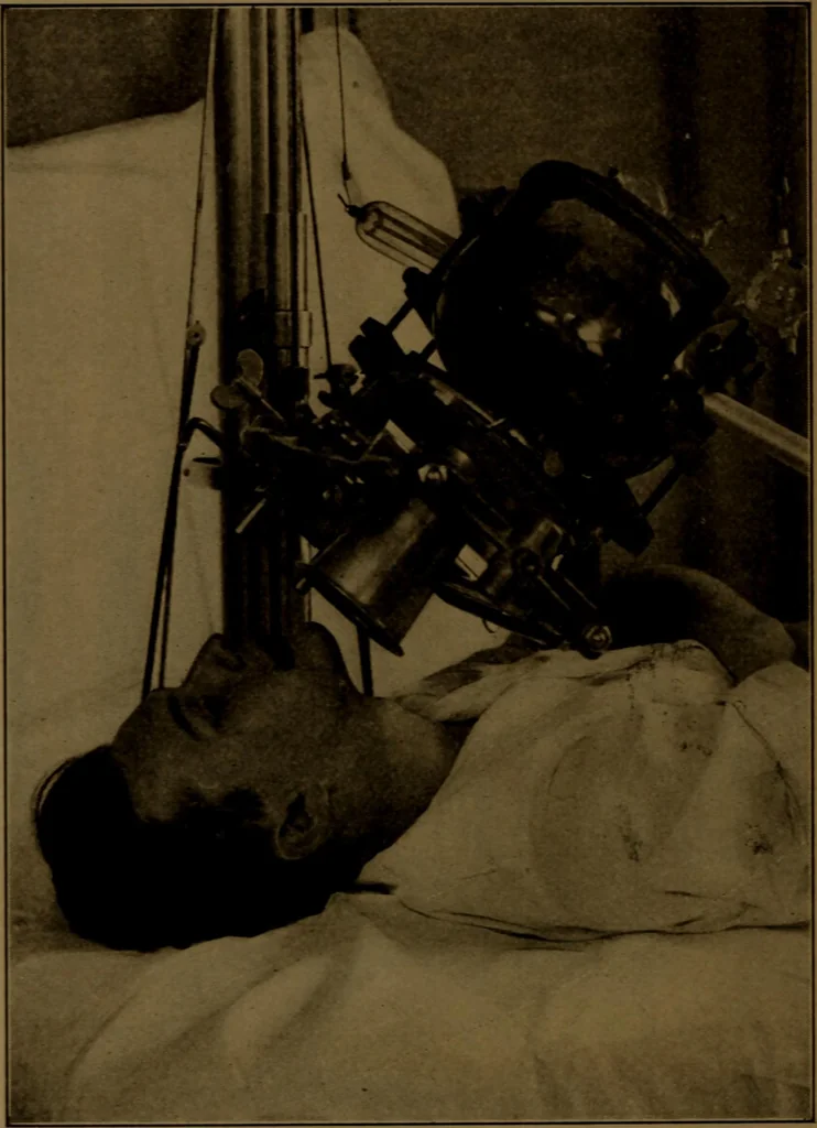 An illustration from X-ray manual : U.S. Army, 1917, leaf 239