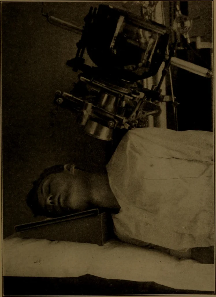 An illustration from X-ray manual : U.S. Army, 1917, leaf 240