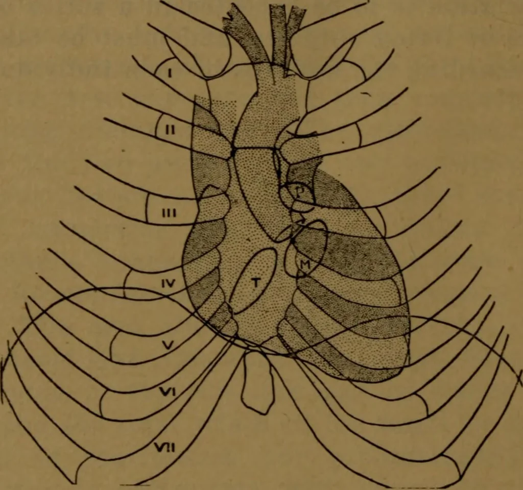 An illustration from X-ray manual : U.S. Army, 1917, leaf 253