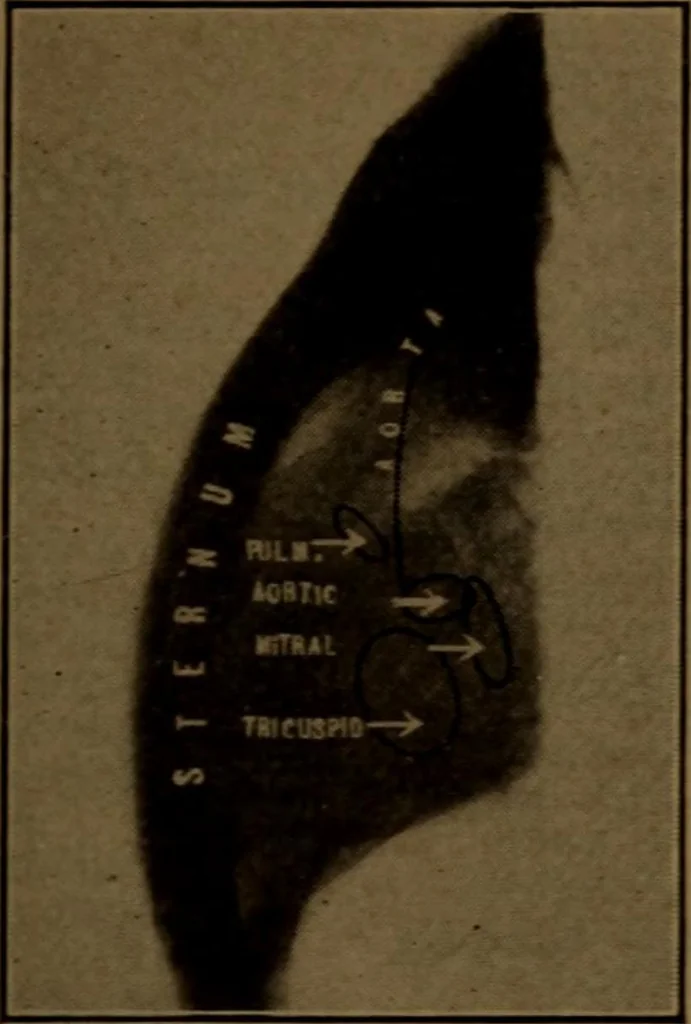 An illustration from X-ray manual : U.S. Army, 1917, leaf 254