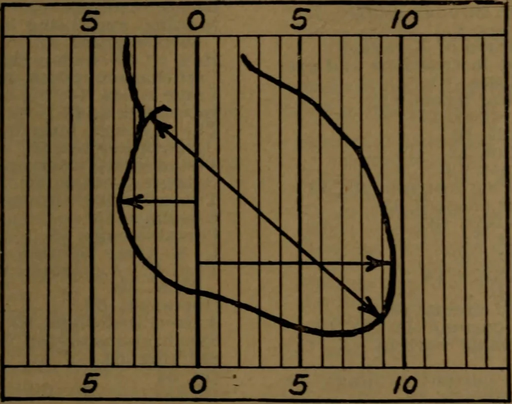 An illustration from X-ray manual : U.S. Army, 1917, leaf 254