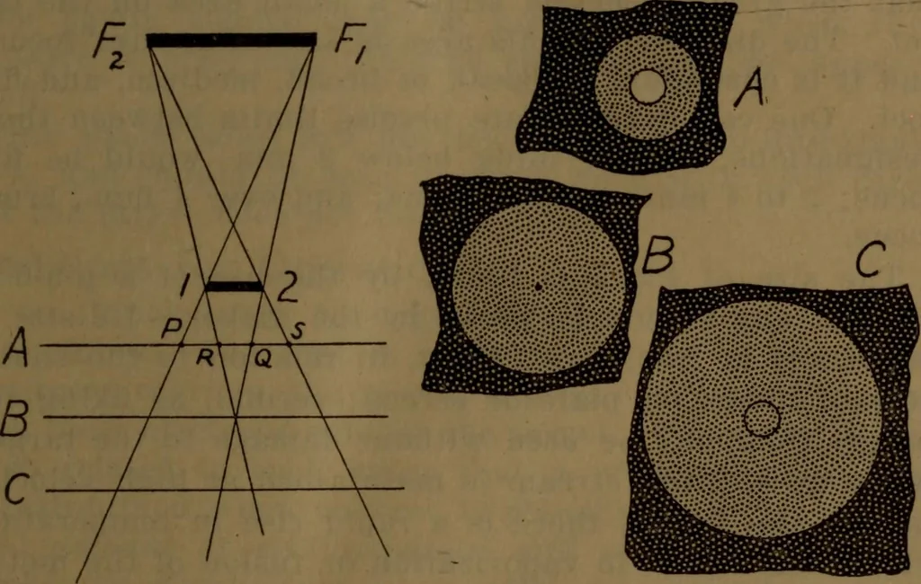 An illustration from X-ray manual : U.S. Army, 1917, leaf 36