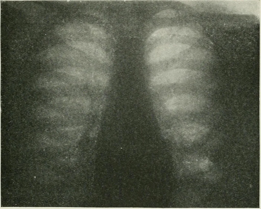 An illustration from X-rays, how to produce and interpret them, 1915, leaf 116