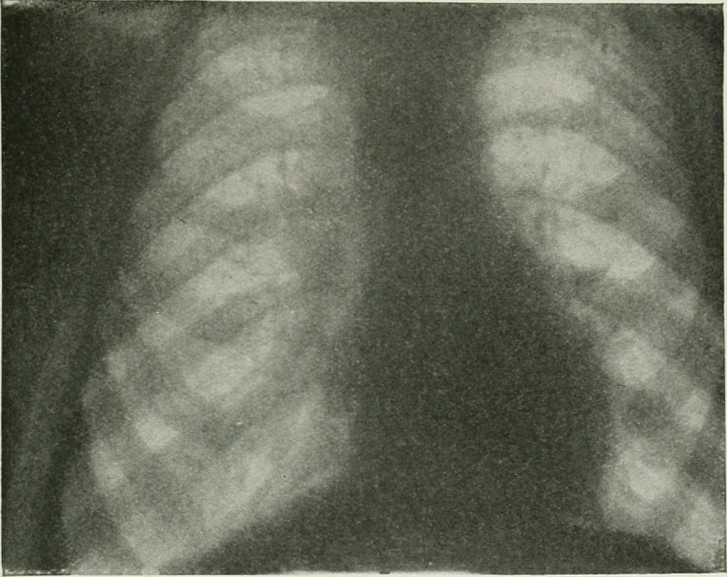 An illustration from X-rays, how to produce and interpret them, 1915, leaf 120