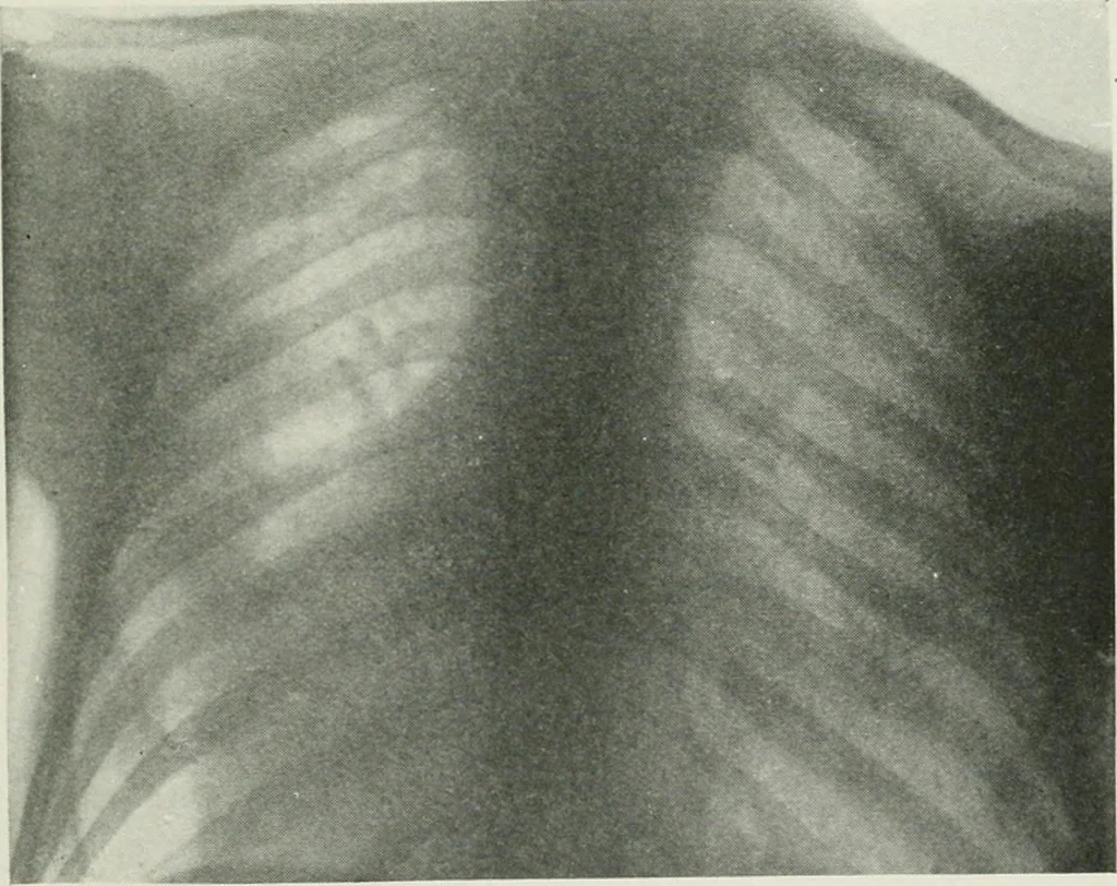 An illustration from X-rays, how to produce and interpret them, 1915, leaf 120
