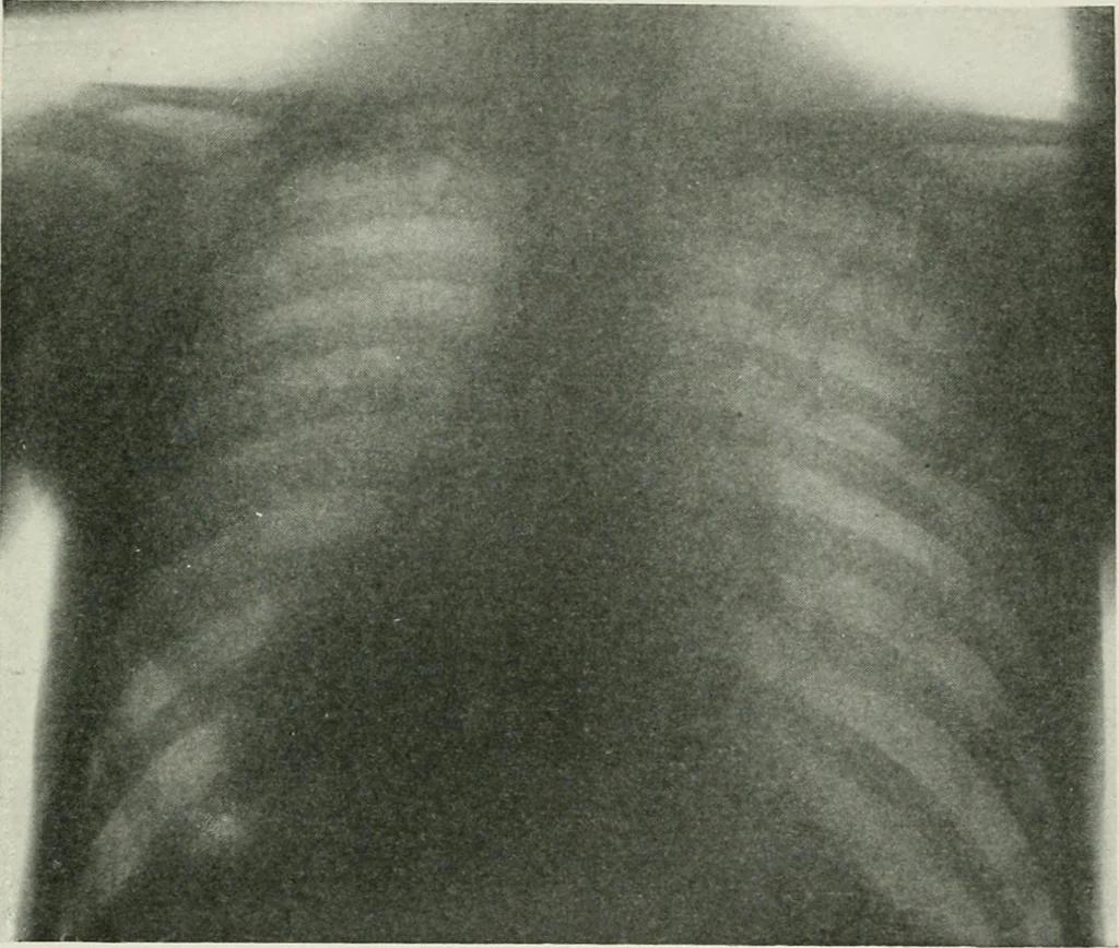 An illustration from X-rays, how to produce and interpret them, 1915, leaf 130