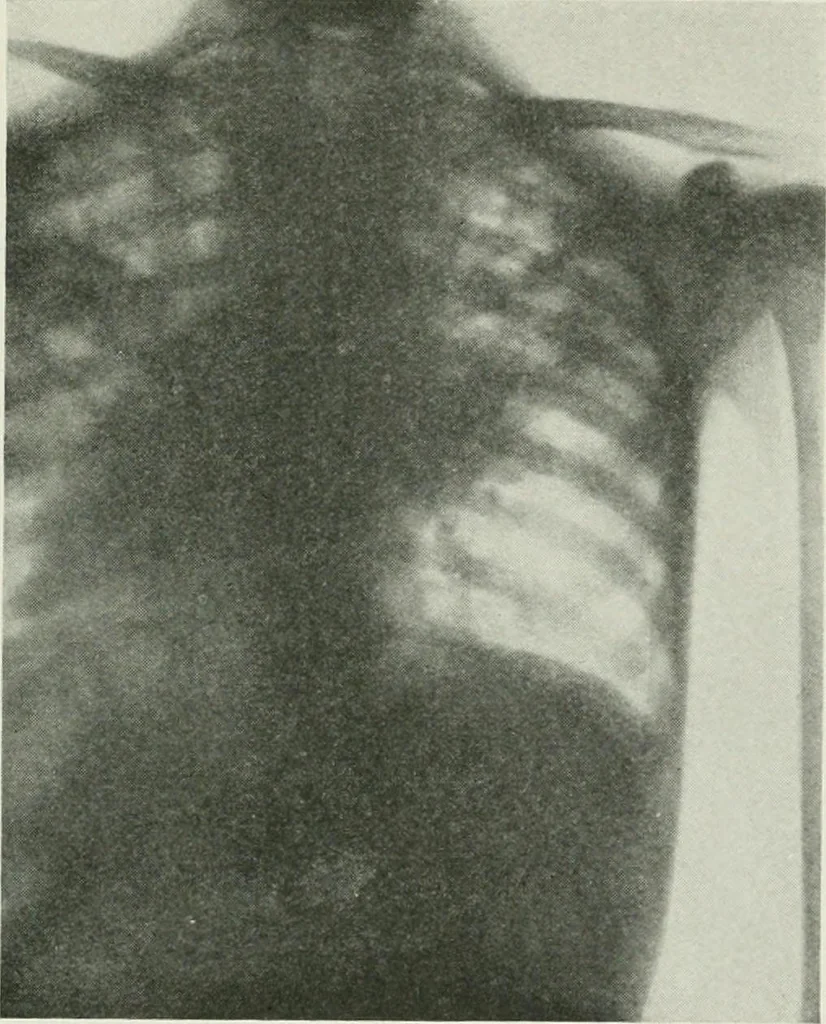 An illustration from X-rays, how to produce and interpret them, 1915, leaf 132