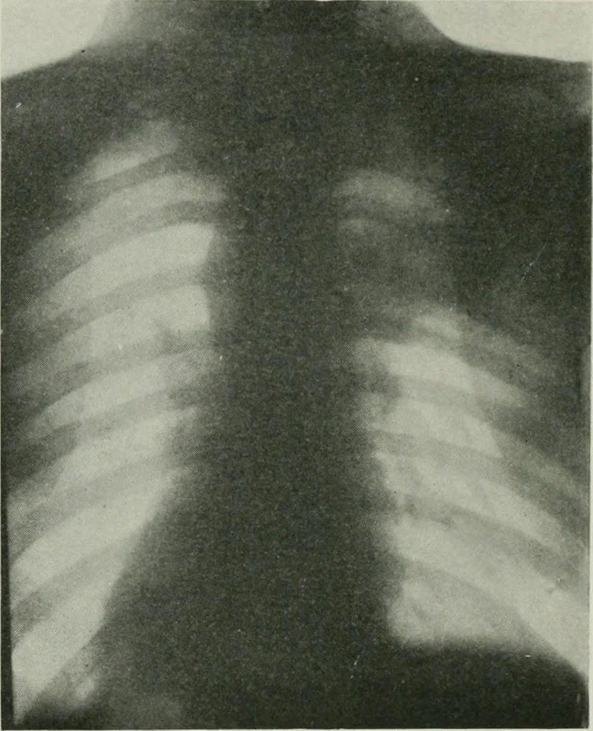 An illustration from X-rays, how to produce and interpret them, 1915, leaf 133