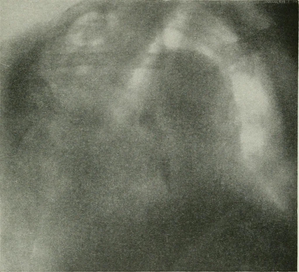 An illustration from X-rays, how to produce and interpret them, 1915, leaf 142