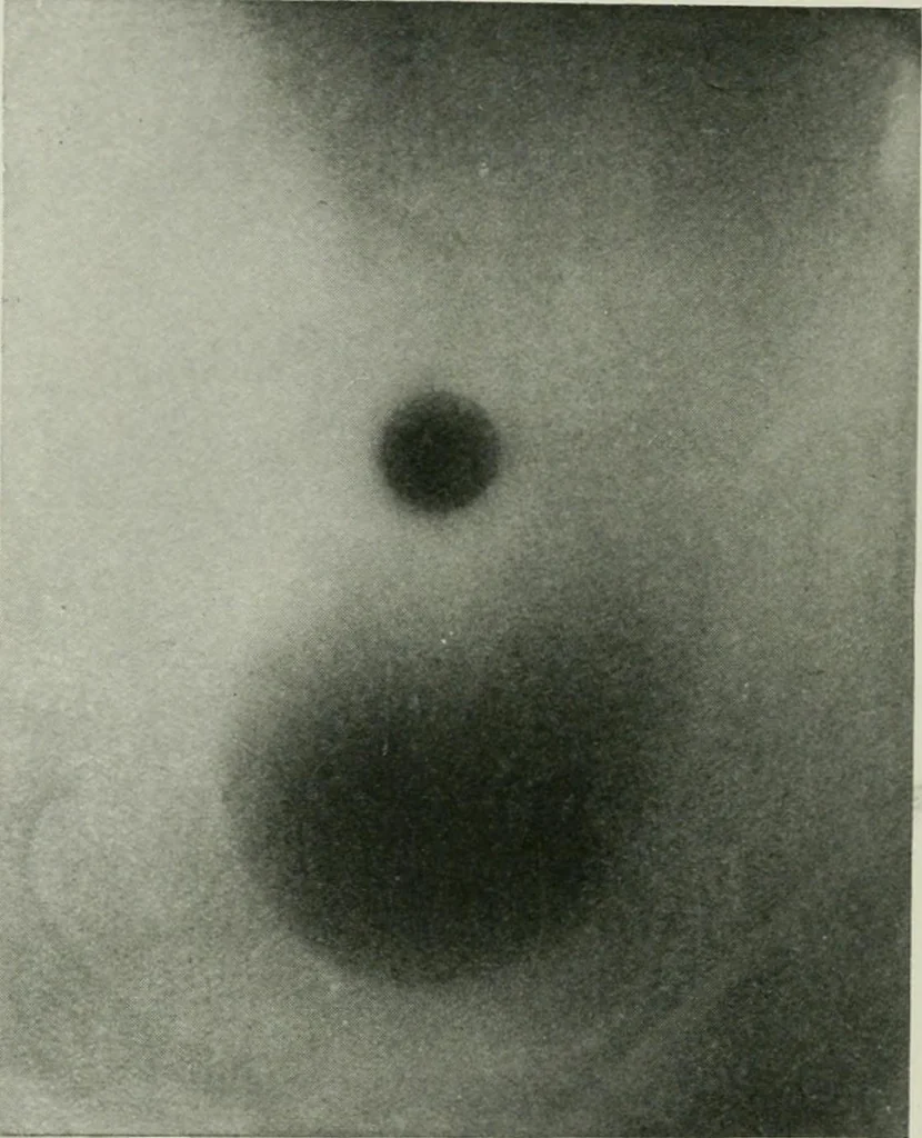 An illustration from X-rays, how to produce and interpret them, 1915, leaf 145