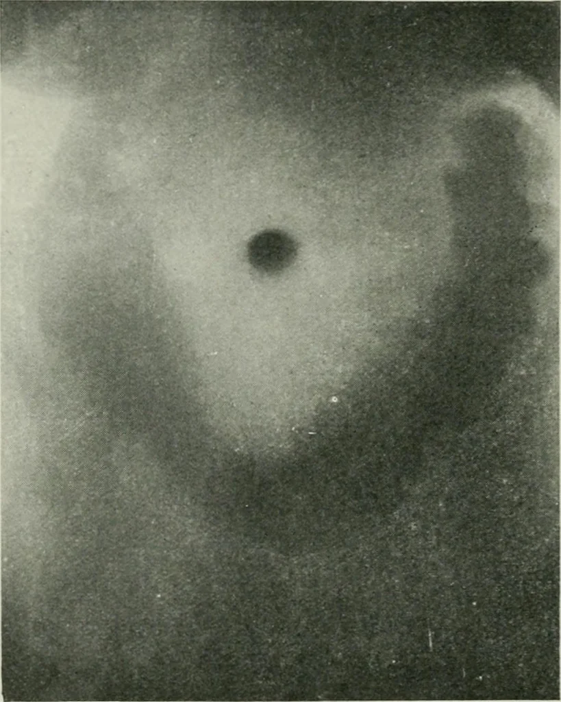 An illustration from X-rays, how to produce and interpret them, 1915, leaf 157